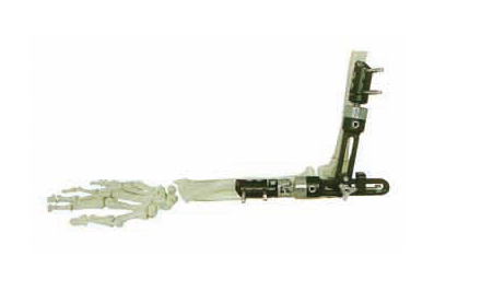 HM-10601肘關節(jié)系列